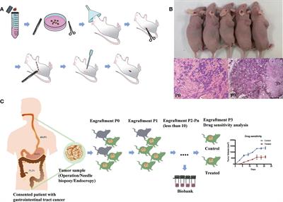 Patient-derived xenograft models for gastrointestinal tumors: A single-center retrospective study